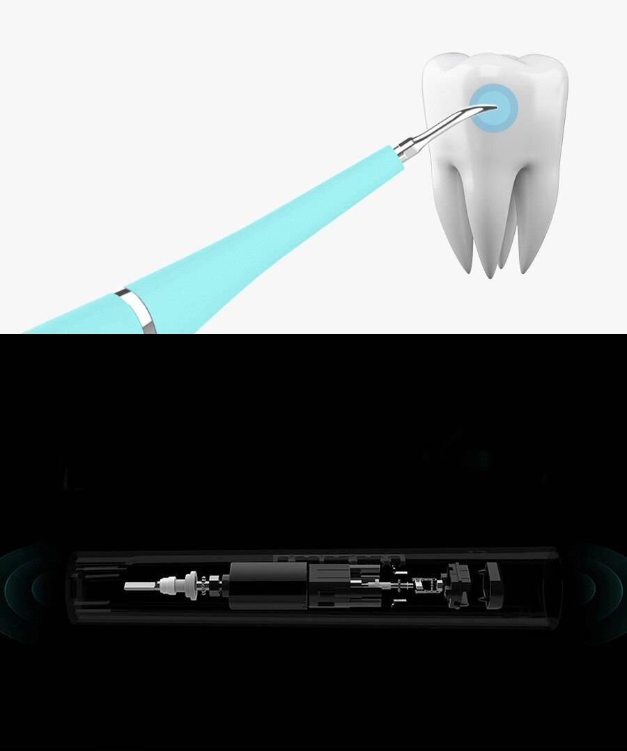 Electric Ultrasonic Dental Scaler Electric Ultrasonic Dental Scaler